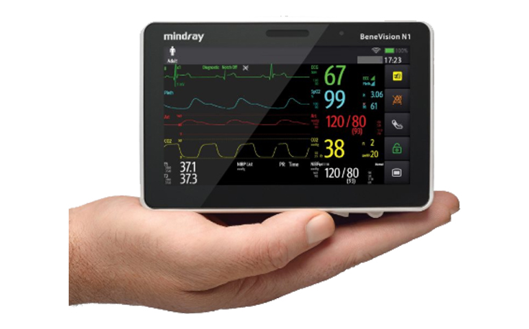 Transport Monitor