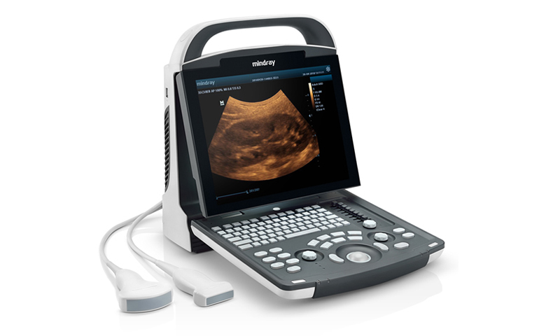 Ultra Sound Scanner
