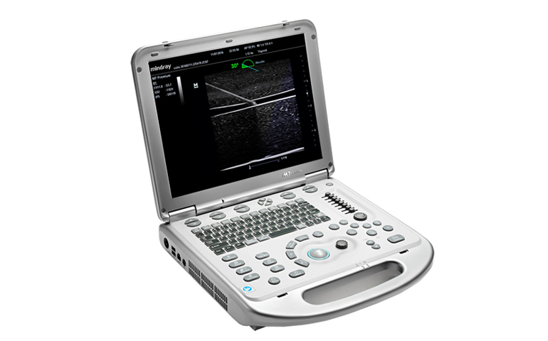Ultra Sound Scanner